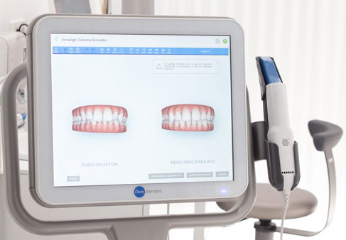 Invisalign Segovia